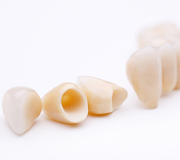 Woburn Dental Crowns and Dental Bridges
