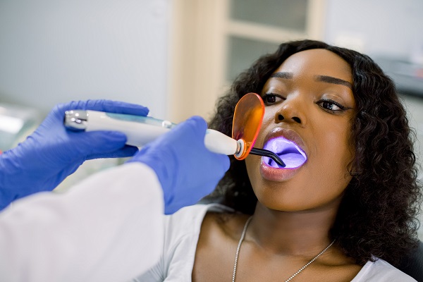 How A Dental Filling Is Used To Address Tooth Decay
