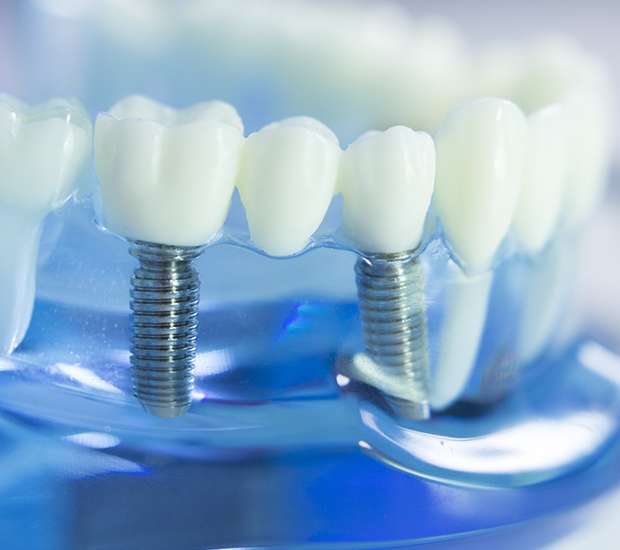 Woburn Dental Implants