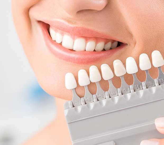 Woburn Dental Veneers and Dental Laminates