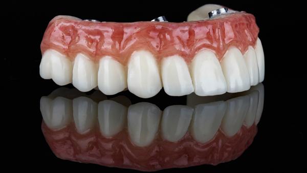 What Happens If I Need My Implant Supported Dentures Repaired?