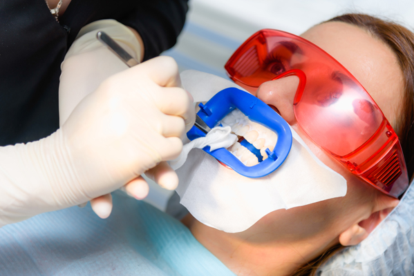 How Does In Office Professional Teeth Whitening Work?